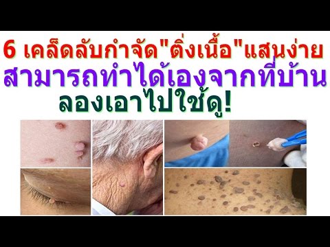นักเต้นหน้าอกเล็ก ความเห็นหน้าอกเล็ก