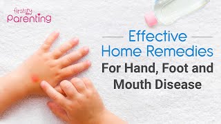 8 Effective  Home Remedies for Hand, Foot, and Mouth Disease in Children
