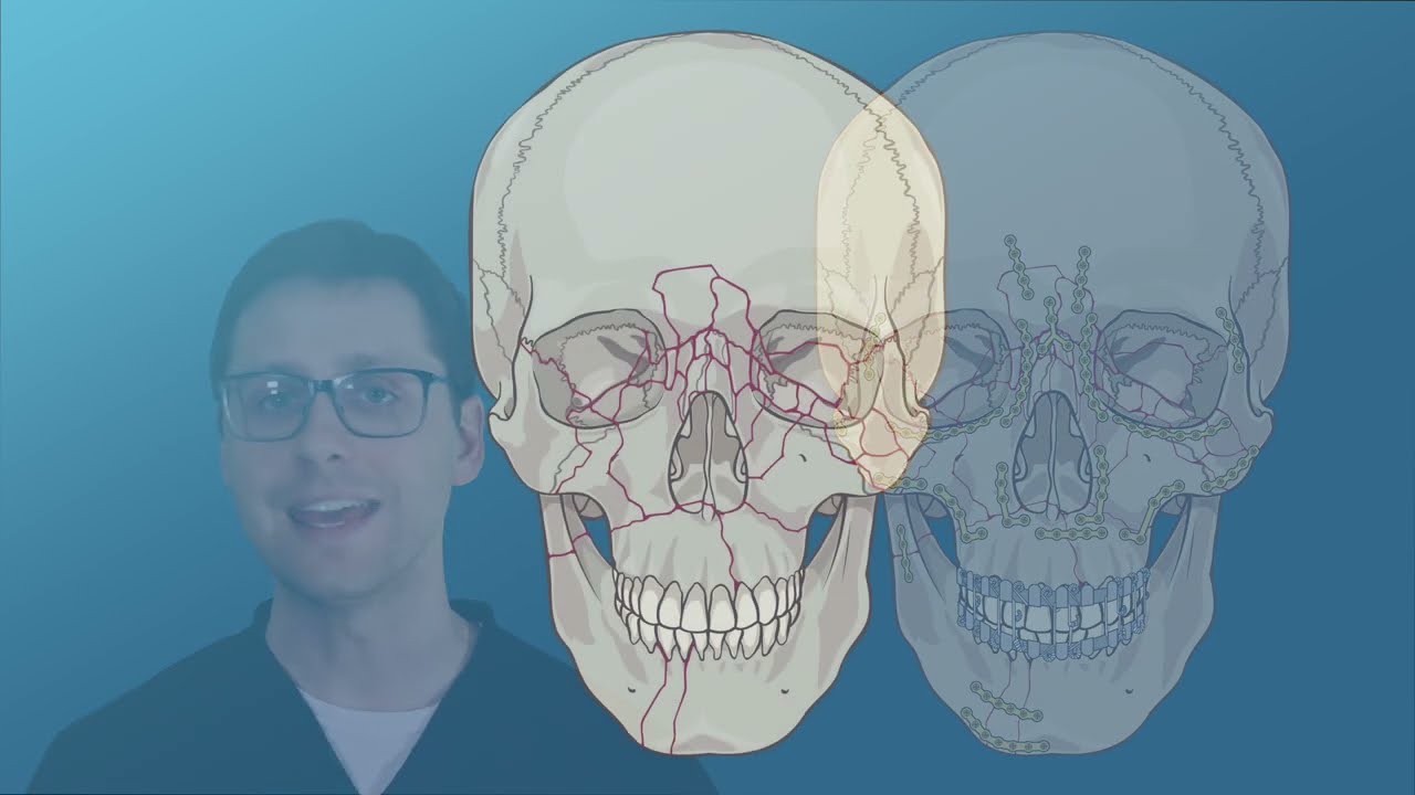 Facial Fracture Reporting Course