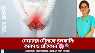 মেয়েদের যৌনাঙ্গে চুলকানি ও ফাঙ্গাল ইনফেকশন কেন হয়? Causes of women&#39;s genital fungal infection!