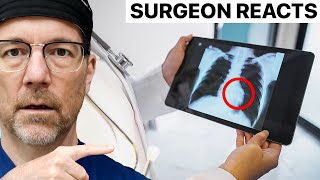 Die 5 schlimmsten Krebsarten | Reaktionen eines Chirurgen