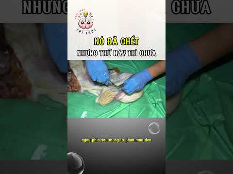 Con Bạch Tuộc Chết Nhưng Thứ Này Vẫn Sống