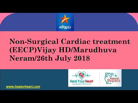 Non-Surgical EECP: Vijay HD/Marudhuva Neram/26th July 2018
