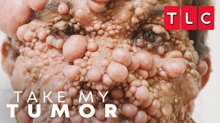 New Series | Take My Tumor | TLC