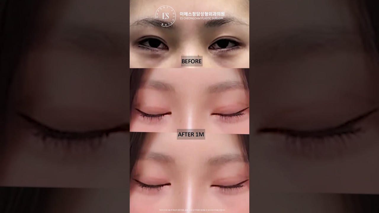 이에스 유튜브