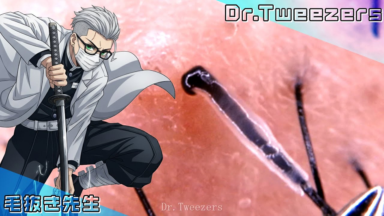 This is a video clip of hair for educational purposes.