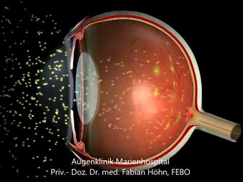 Das Sehen - so funktioniert unser Auge