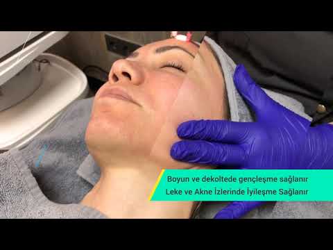 Pervin Dinçer | BabyFace Beauty Uygulaması