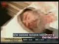 Footage Of Saddam Hussein Laying On The Stretcher After Being Executed