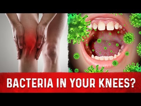 Deeper Causes of Pain Inflammation – Dr Berg