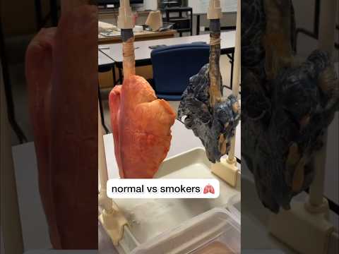 How smokers lungs look like