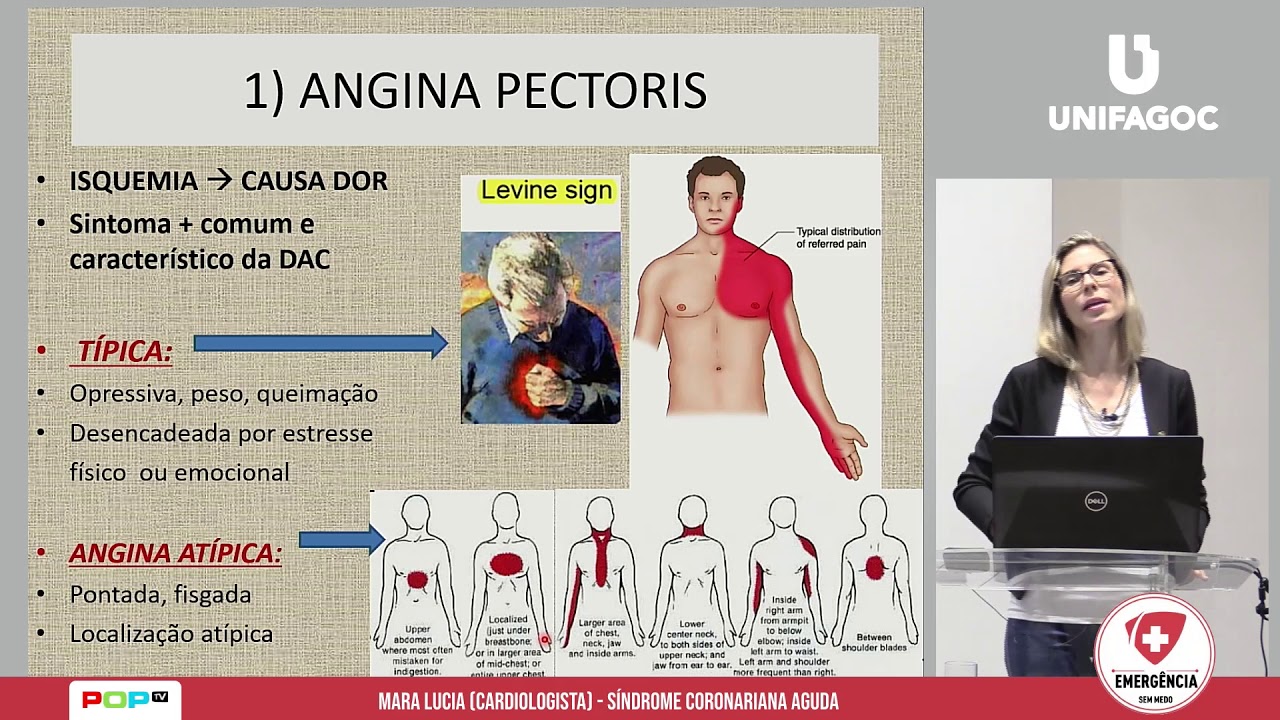 AULA 7 -  Síndrome Coronariana Aguda