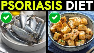 Psoriasis Treatment and Diet: Foods to Eat and Avoid