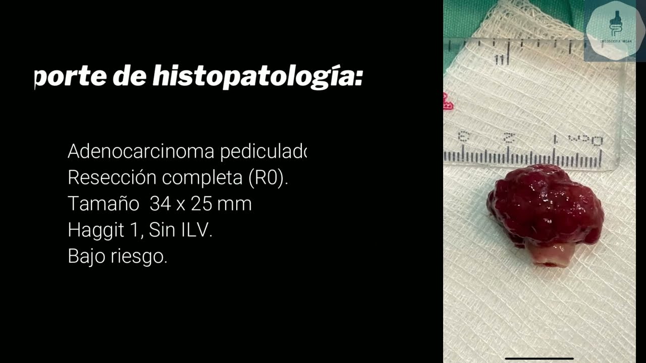 Jorge Pablo Pérez Macías-14