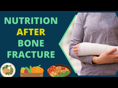 Diet for Bone Fracture Recovery