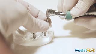 Vídeo como extraer un tornillo roto de un implante dental