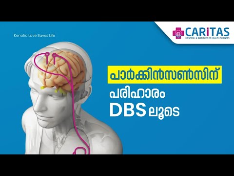 Get to know more about parkinsonism