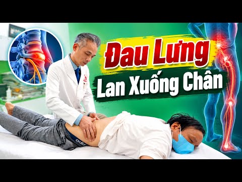 Chưa Từng Đau Lưng Mà Tê Từ Mông Xuống Tận Gót Chân