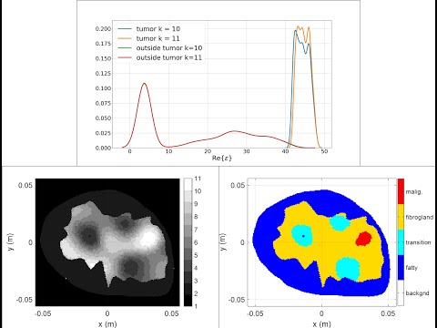 Scattered Density breast detailed demonstration of iterative unsupervised machine learning segmentation technique