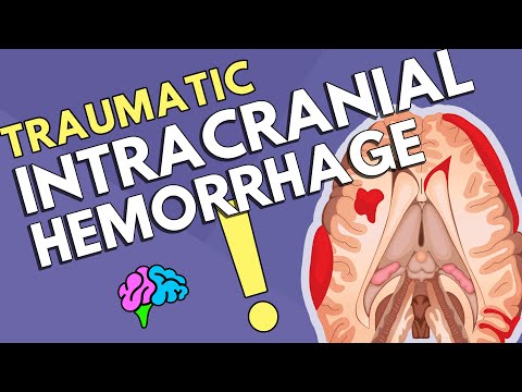 Intracranial Hemorrhage