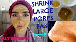 How To Get Rid of Large Pores | Get Tighter & Smooth Skin Naturally | Shrink Pores FAST! ~ Immy