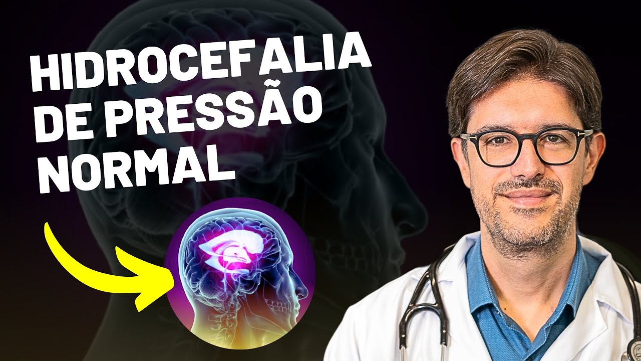 Hidrocefalia de Pressão Normal - Demência Que Tem Cura