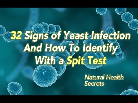 [Natural Health Secrets] Episode 39: 32 Signs of Yeast Infection and How to Identify with Spit Test