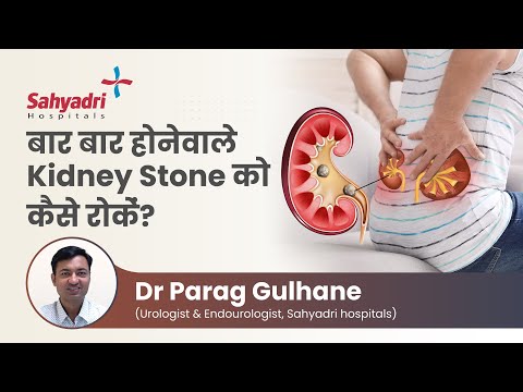 Stone Prevention - Dr. Parag Gulhane 
