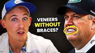 Do you need braces or veneers? Dentist explains