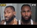 Patchy Beard To Full Beard In 15 Minutes