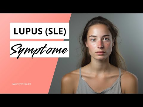 Lupus: Symptome der Autoimmunerkrankung