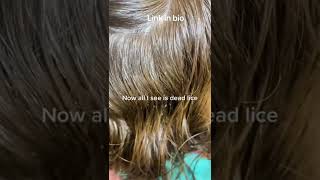 Eliminating lice with the best lice treatment