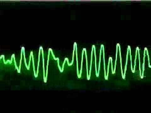 ekg ritimleri