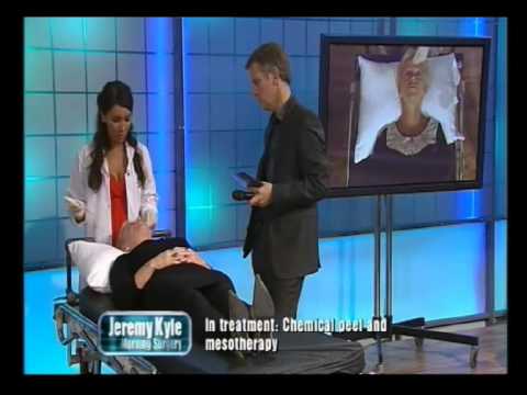 Come in un giorno per liberarsi da lentiggini Su carne estrema come pigmentary posto