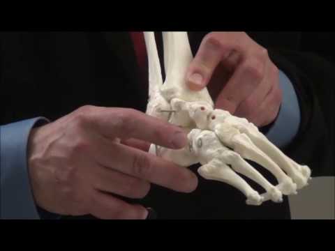 Treatment of Clubfoot Demonstration- Large Model