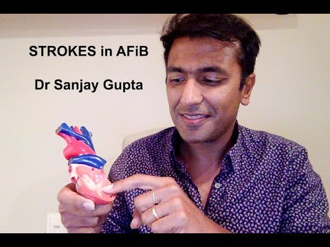 Strokes in atrial fibrillation