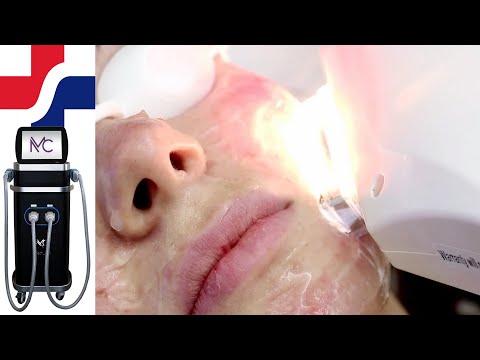 Intense Pulsed Light for Hair Removal and Skin Rejuvenation - The MediLight