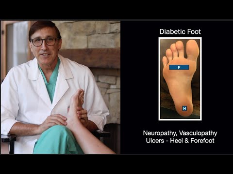 Got Foot Pains? Diabetes? 2 minutes?