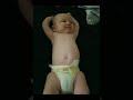 Diaper explosion