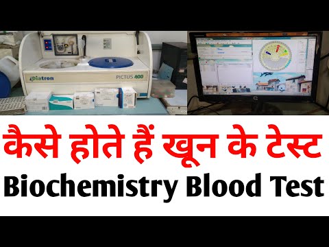 Biochemistry Blood Test Machine | PICTUS | Metro Lab Machine | Sciency Duniya