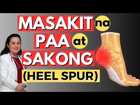 Masakit na Paa at Sakong (Heel Spur). - By Doc Liza Ramoso-Ong