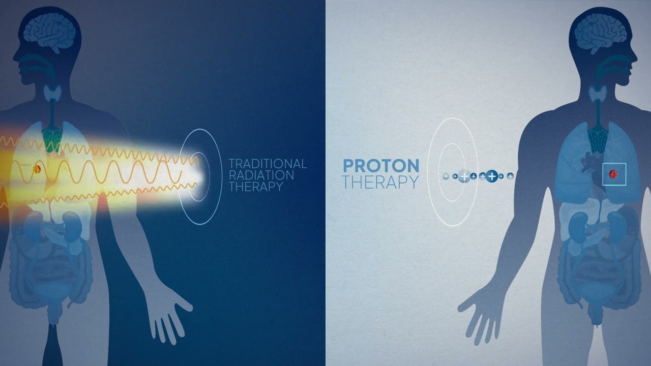 Watch video titled What is Proton Therapy Penn Medicine Explains video on YouTube