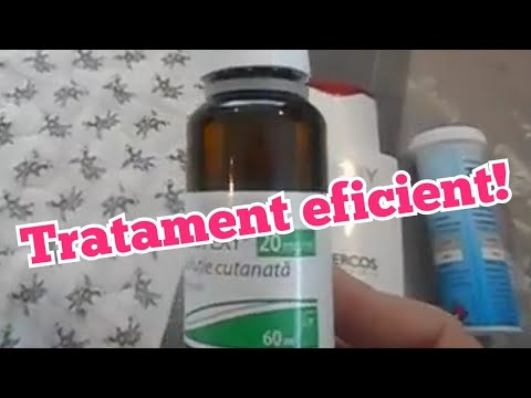 Caderea parului - cauze si tratamente - Farmacia Arsene