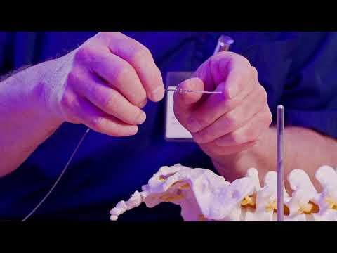 SKMG Erklärfilm Schrittmacher Schließmuskel