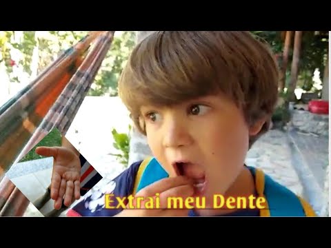 APRENDA COMO EXTRAIR UM DENTE RÁPIDO