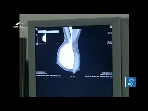 Senado pode votar projeto que amplia faixa etária para mamografias pelo SUS