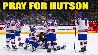 Download lagu Cole Hutson Injury Hit By Puck in Head Stretchered Off Ice | USA vs Switzerland 2026 World Juniors mp3