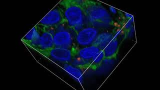 NAFLD-on-a-chip