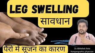 Best Homeopathic Medicine For Oedema, How To Rid Of Swelling Easily ।2024👇