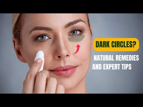Banish Dark Circles: Natural Remedies and Expert Tips